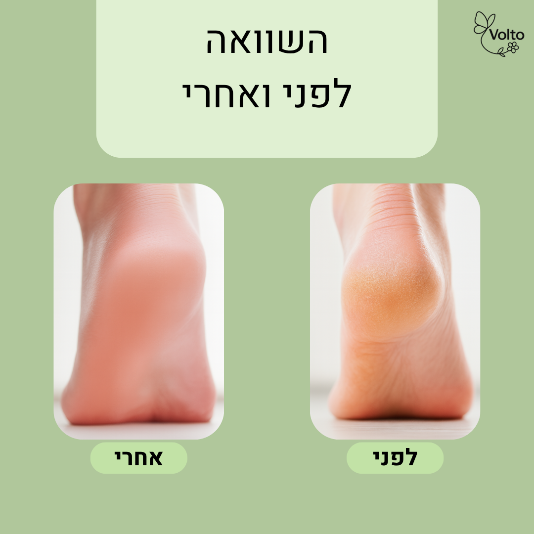 מכשיר פדיקור חשמלי