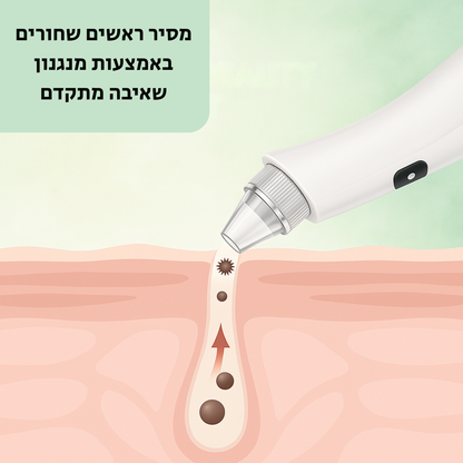 מכשיר להסרת שחורים