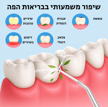 מנקה שיניים בלחץ מים